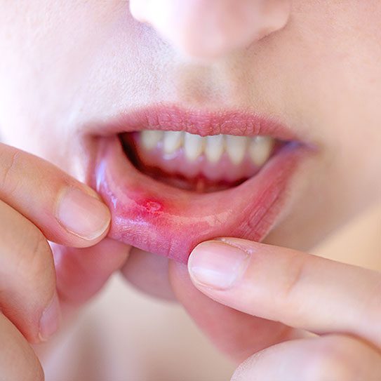 - Colfax Dental